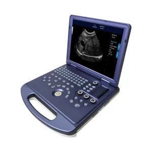 Ultrasound Scanning Machine